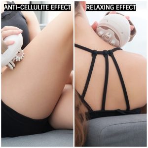 Cellmassager – Masażer antycellulitowy 03